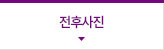 시술후기